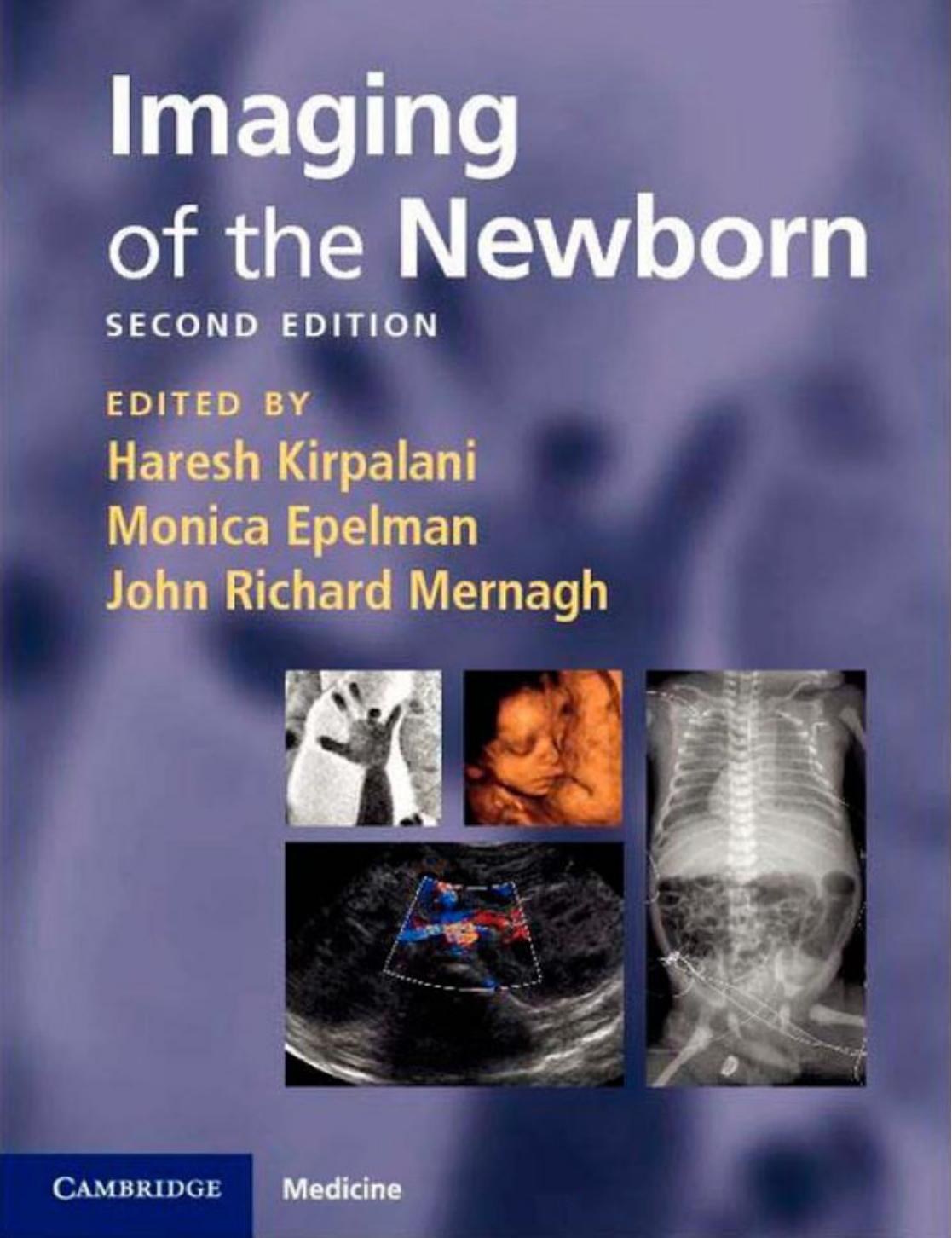 Imaging of the Newborn Baby