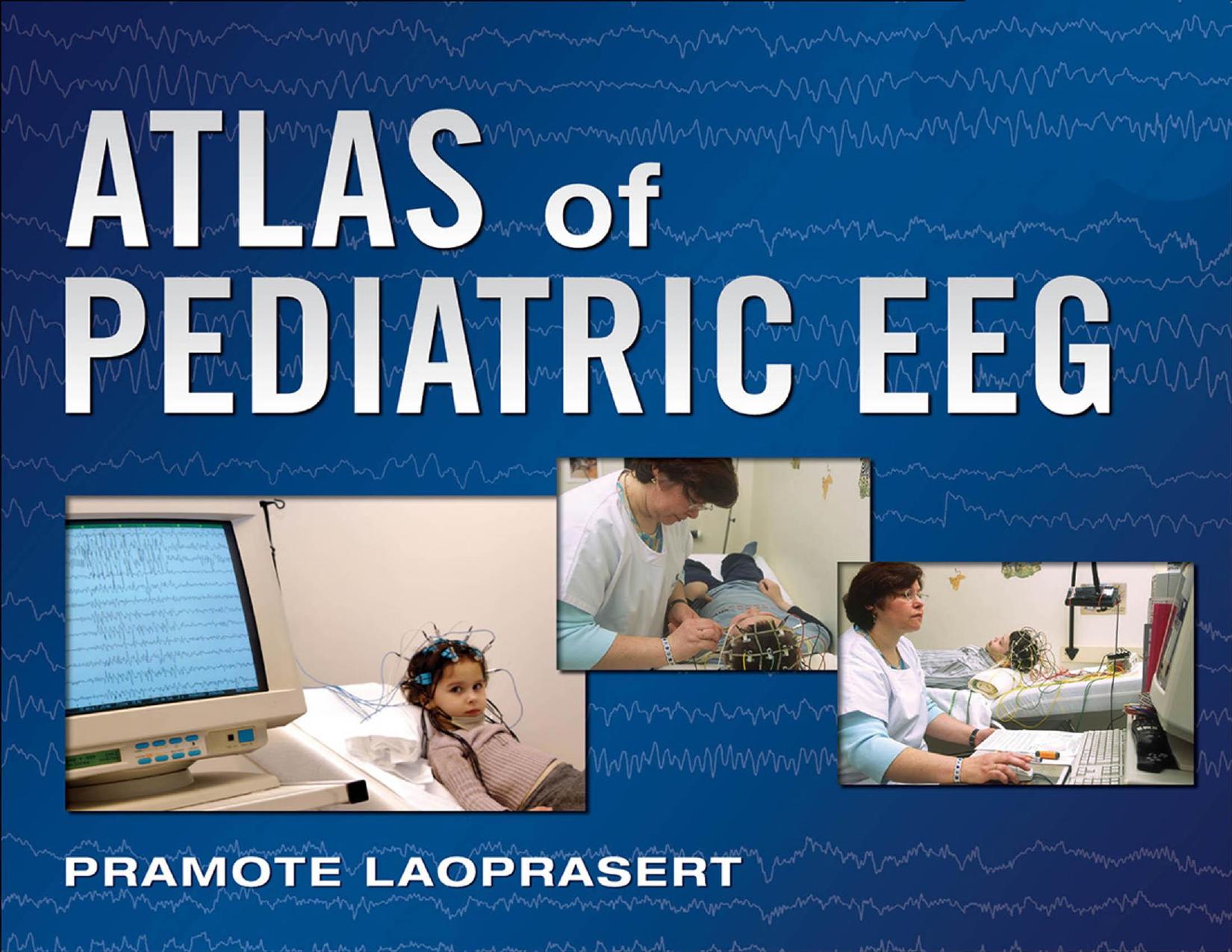 Atlas of Pediatric EEG